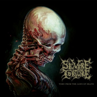 Severe Torture - Torn from the Jaws of Death - CD DIGIPAK + Digital