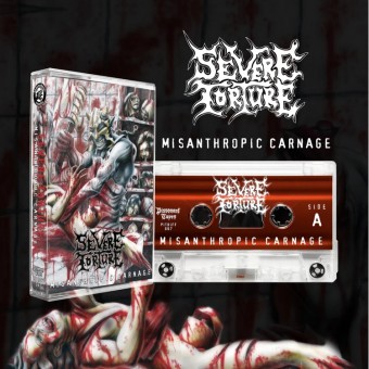 Severe Torture - Misanthropic Carnage - TAPE